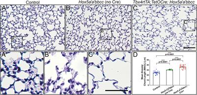 The Lung Elastin Matrix Undergoes Rapid Degradation Upon Adult Loss of Hox5 Function